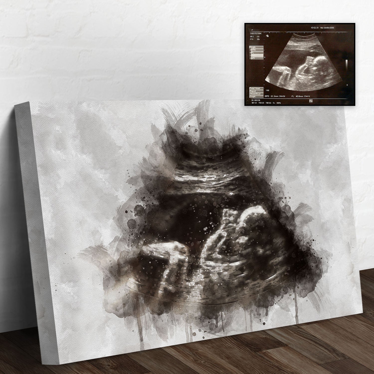 Custom Baby Ultrasound Watercolor Portrait  - Image by Tailored Canvases